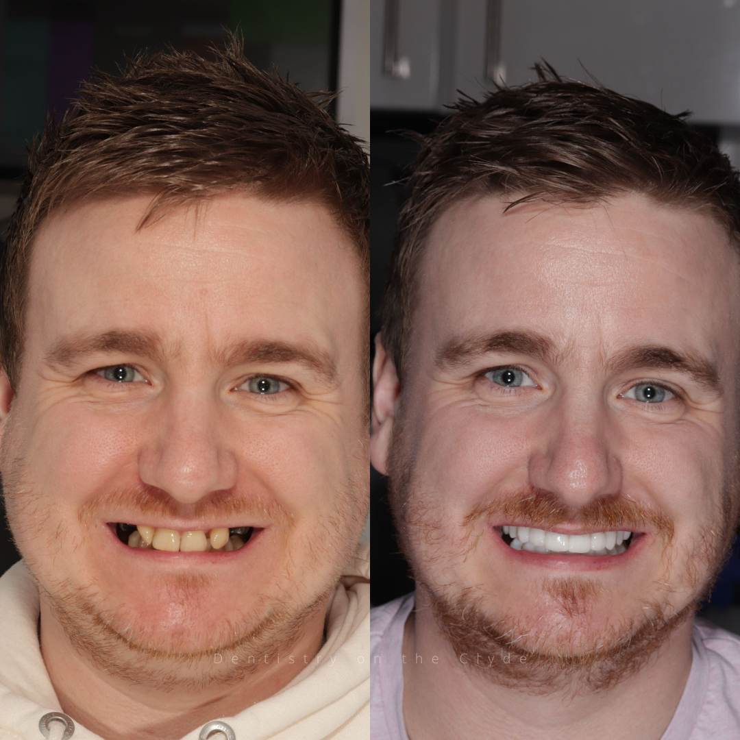 Dentistry On The Clyde | Smile Gallery Before and after treatment
