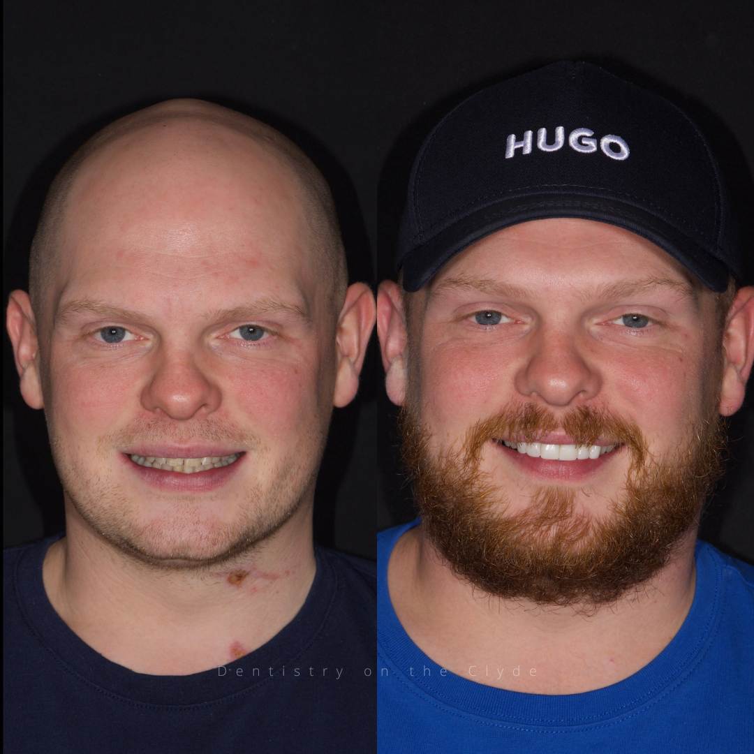 Dentistry On The Clyde | Smile Gallery Before and after treatment