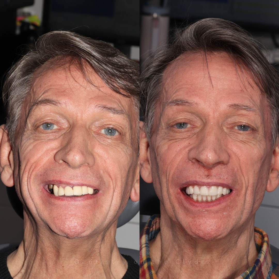 Dentistry On The Clyde | Smile Gallery Before and after treatment