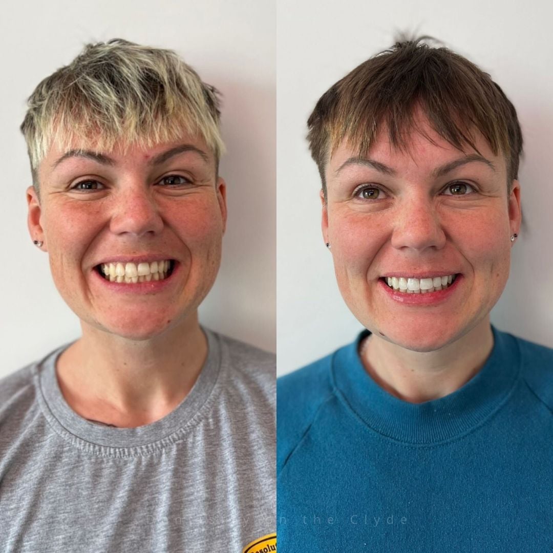 Dentistry On The Clyde | Pain Free Dentist In Gourock Dentistry On The Clyde | Pain Free Dentist In Gourock