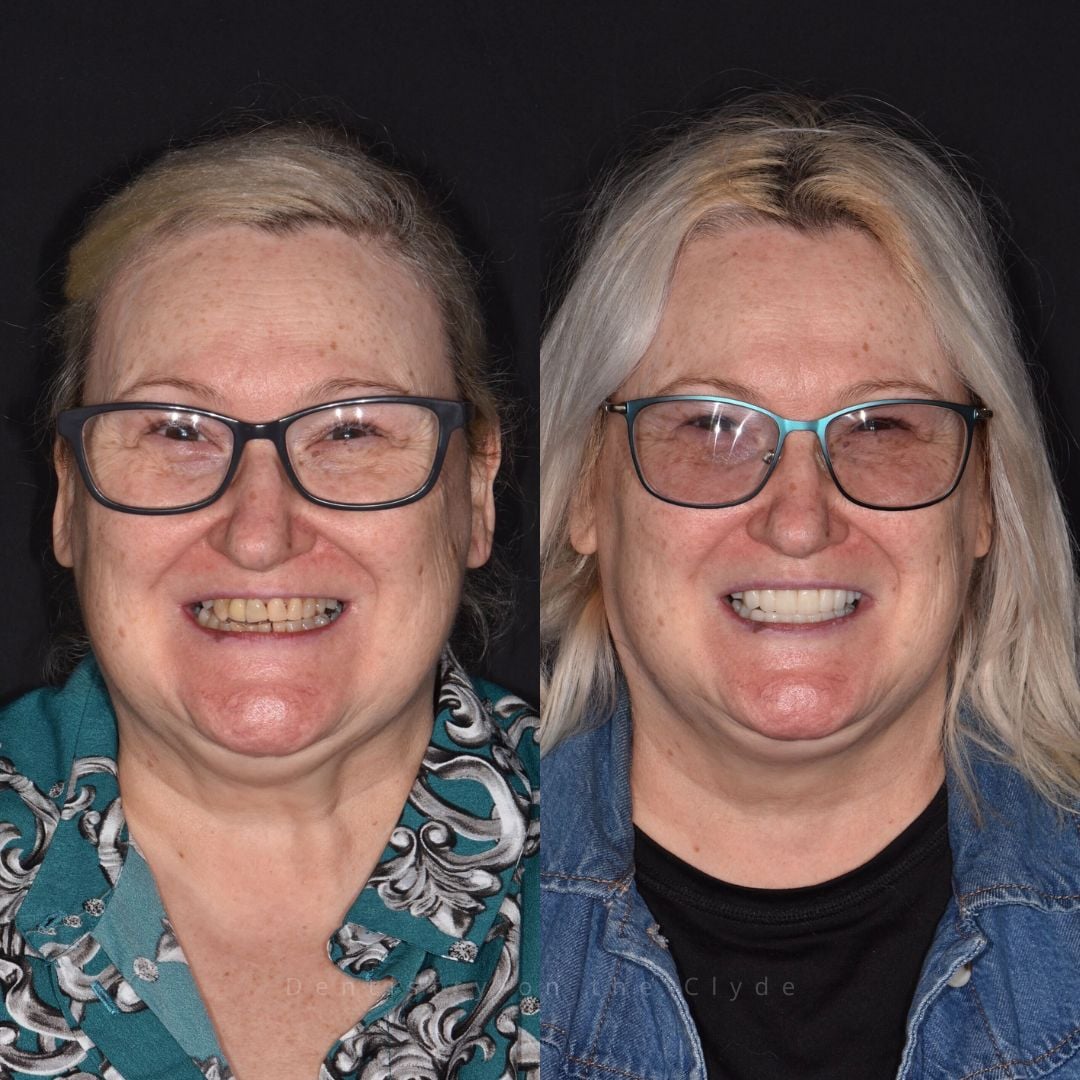 Dentistry On The Clyde | Pain Free Dentist In Gourock Dentistry On The Clyde | Pain Free Dentist In Gourock