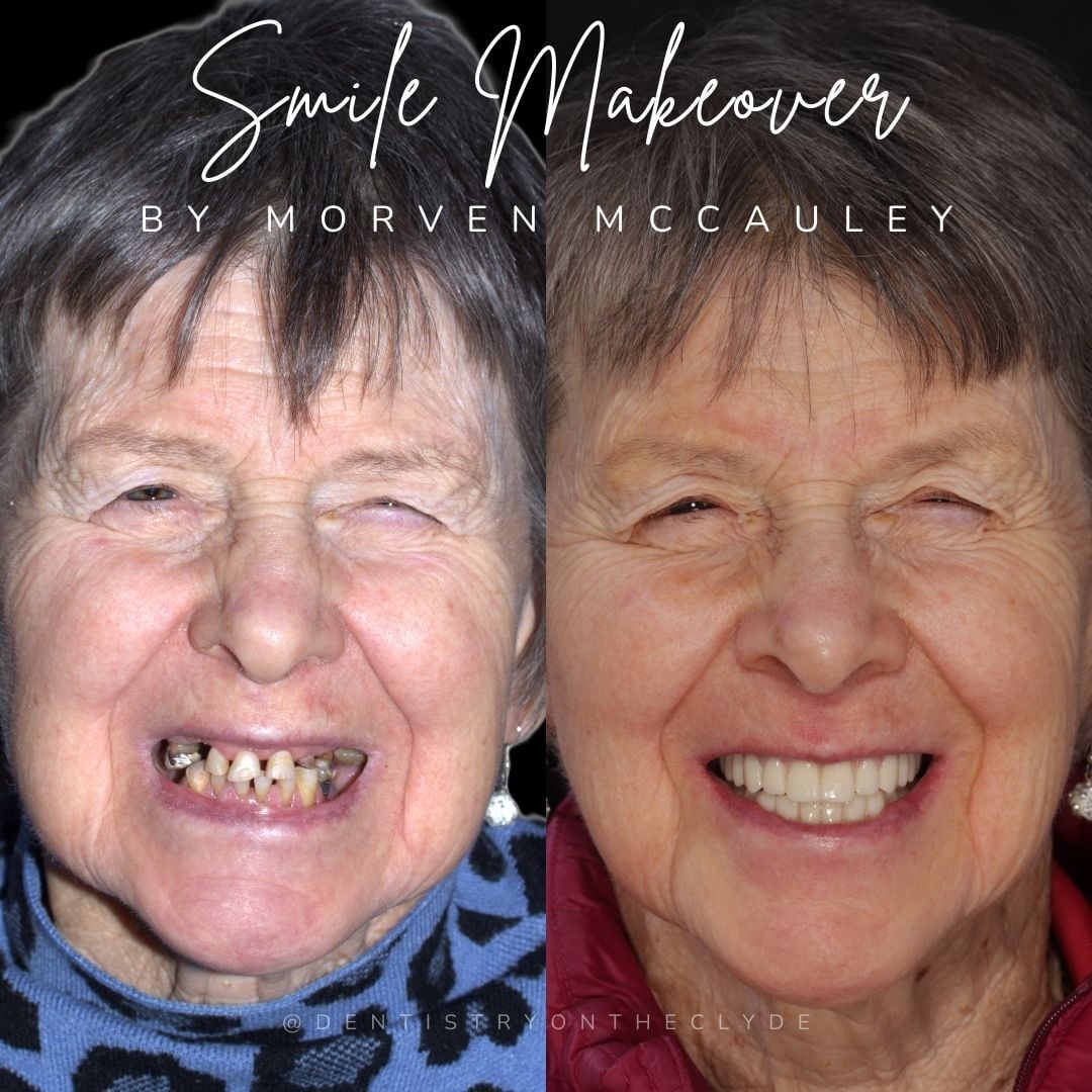 Dentistry On The Clyde | Pain Free Dentist In Gourock Dentistry On The Clyde | Pain Free Dentist In Gourock