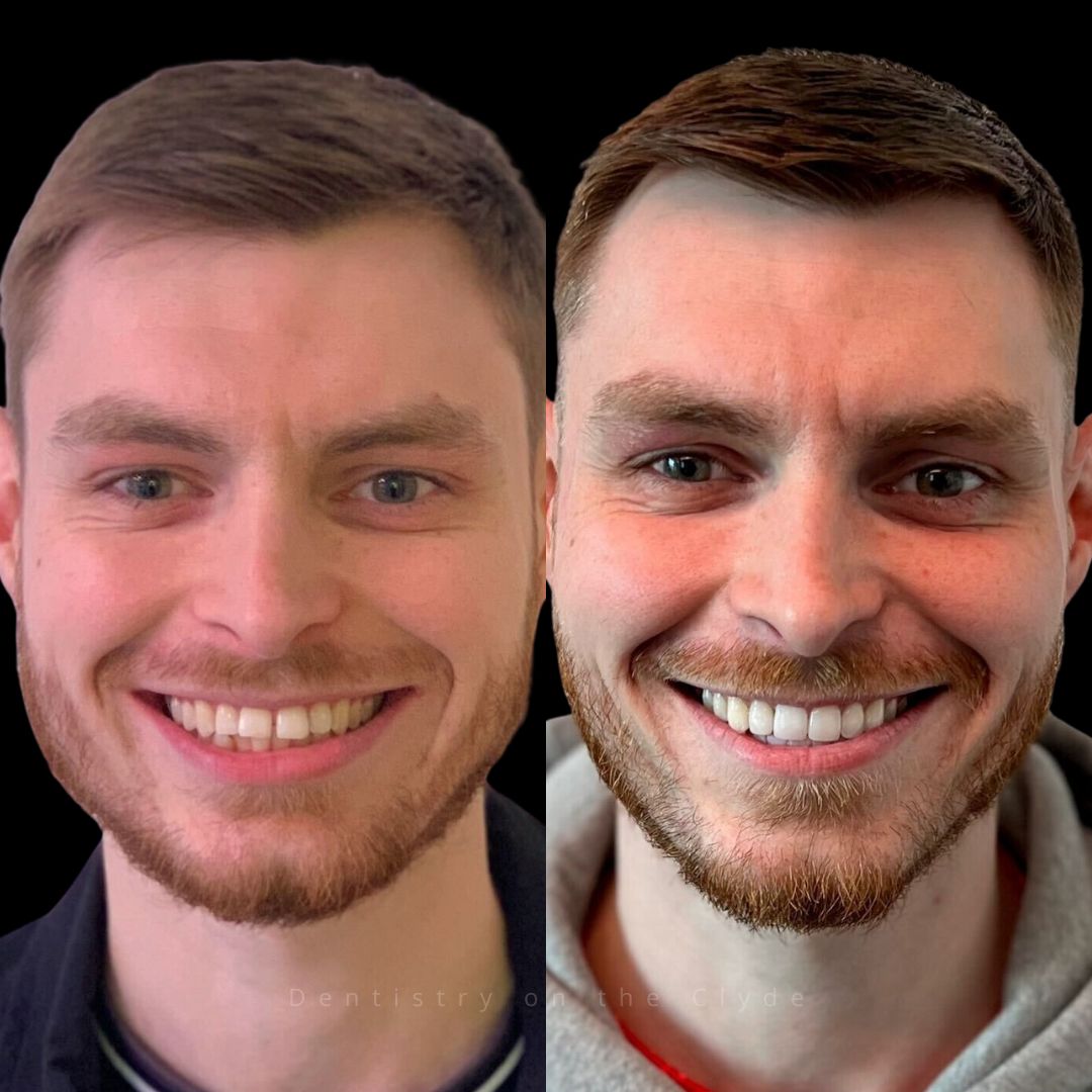 Dentistry On The Clyde | Pain Free Dentist In Gourock Dentistry On The Clyde | Pain Free Dentist In Gourock