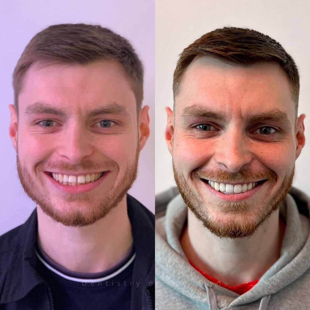Dentistry On The Clyde | Pain Free Dentist In Gourock Dentistry On The Clyde | Pain Free Dentist In Gourock