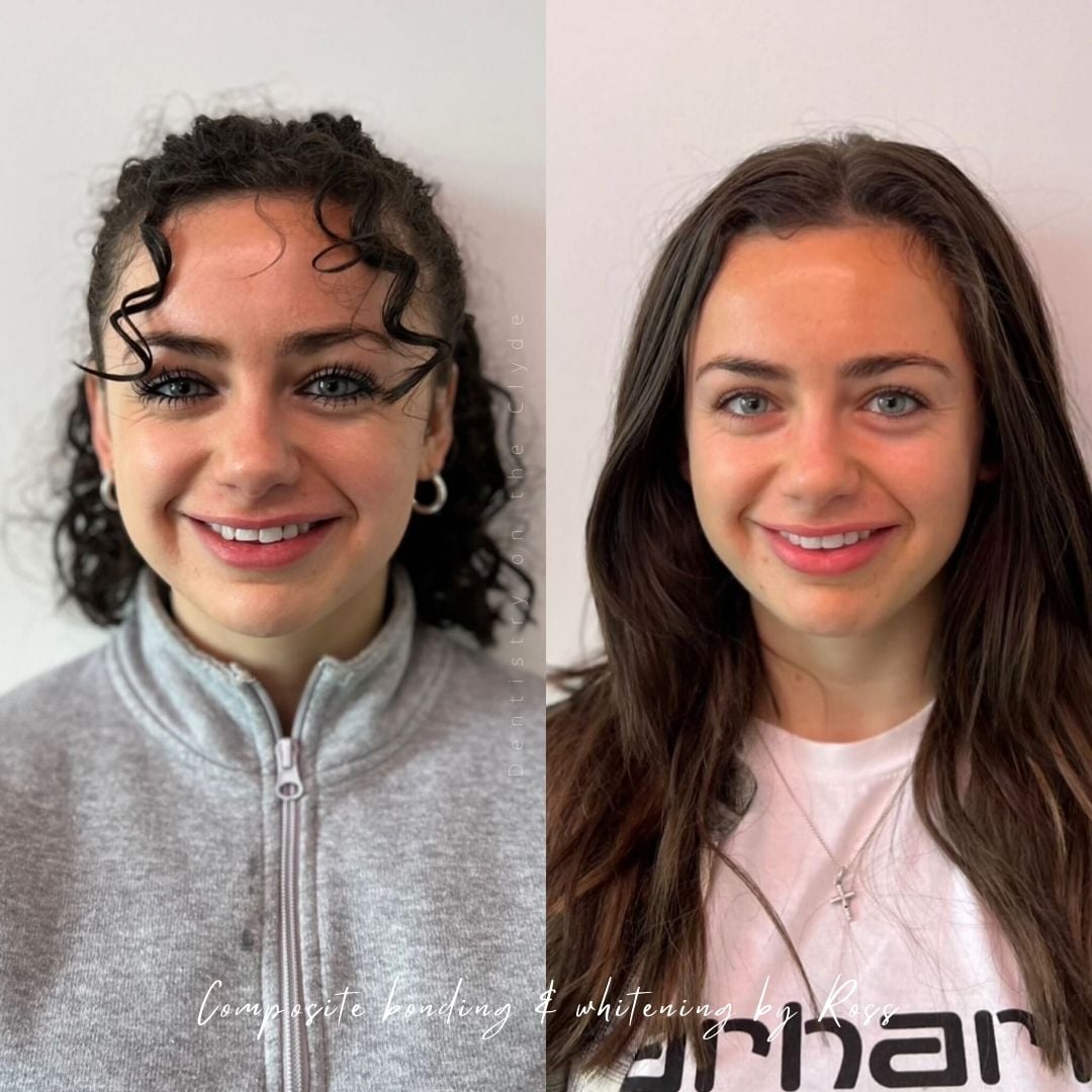 Dentistry On The Clyde | Pain Free Dentist In Gourock Dentistry On The Clyde | Pain Free Dentist In Gourock