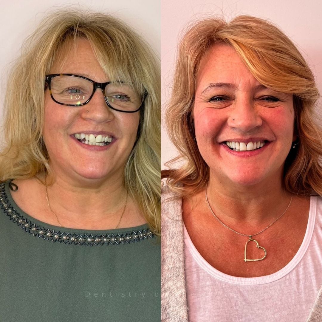 Dentistry On The Clyde | Pain Free Dentist In Gourock Dentistry On The Clyde | Pain Free Dentist In Gourock