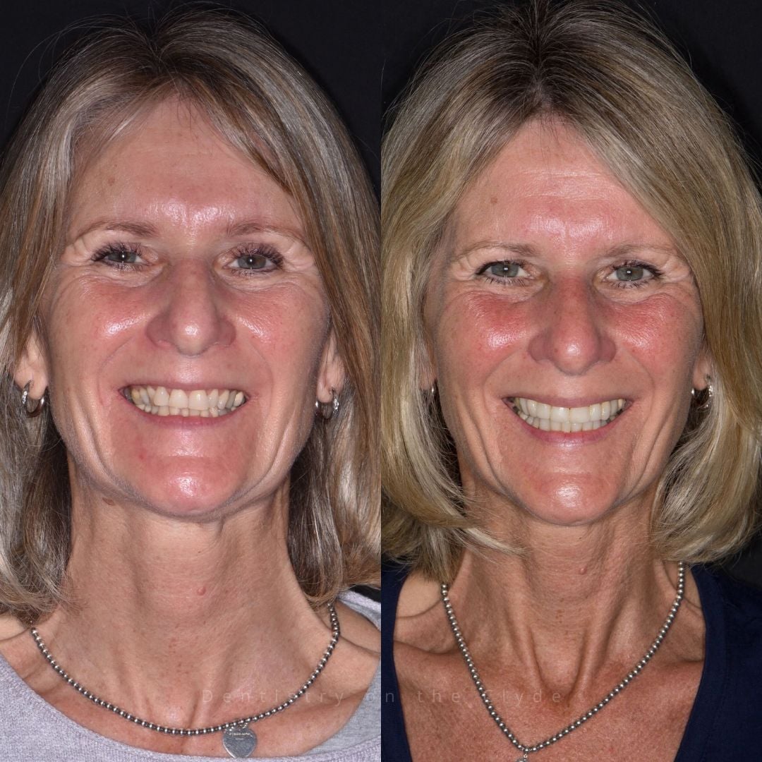 Dentistry On The Clyde | Pain Free Dentist In Gourock Dentistry On The Clyde | Pain Free Dentist In Gourock