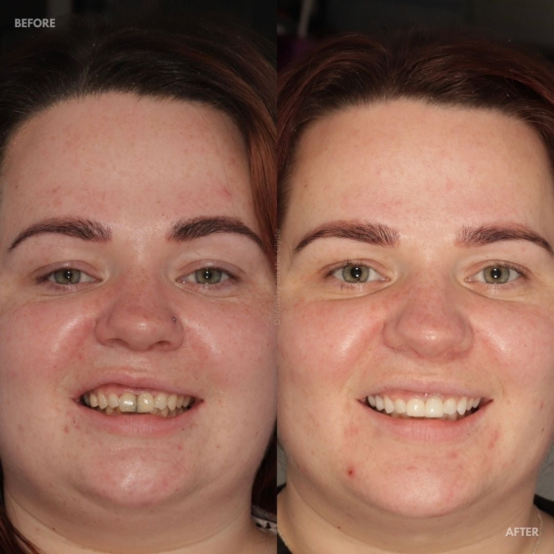 Dentistry On The Clyde | Pain Free Dentist In Gourock Dentistry On The Clyde | Pain Free Dentist In Gourock