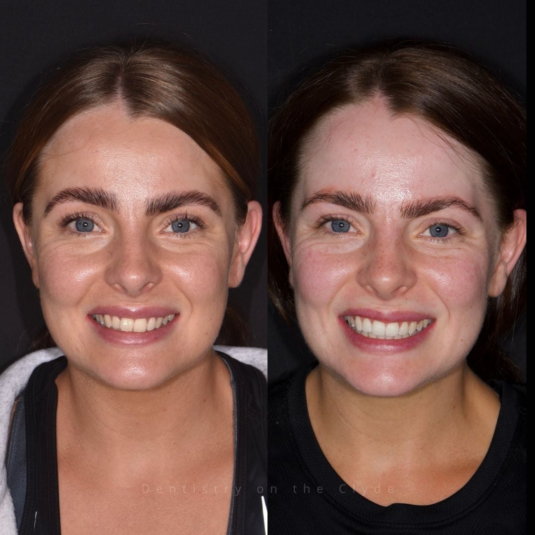 Dentistry On The Clyde | Pain Free Dentist In Gourock Dentistry On The Clyde | Pain Free Dentist In Gourock