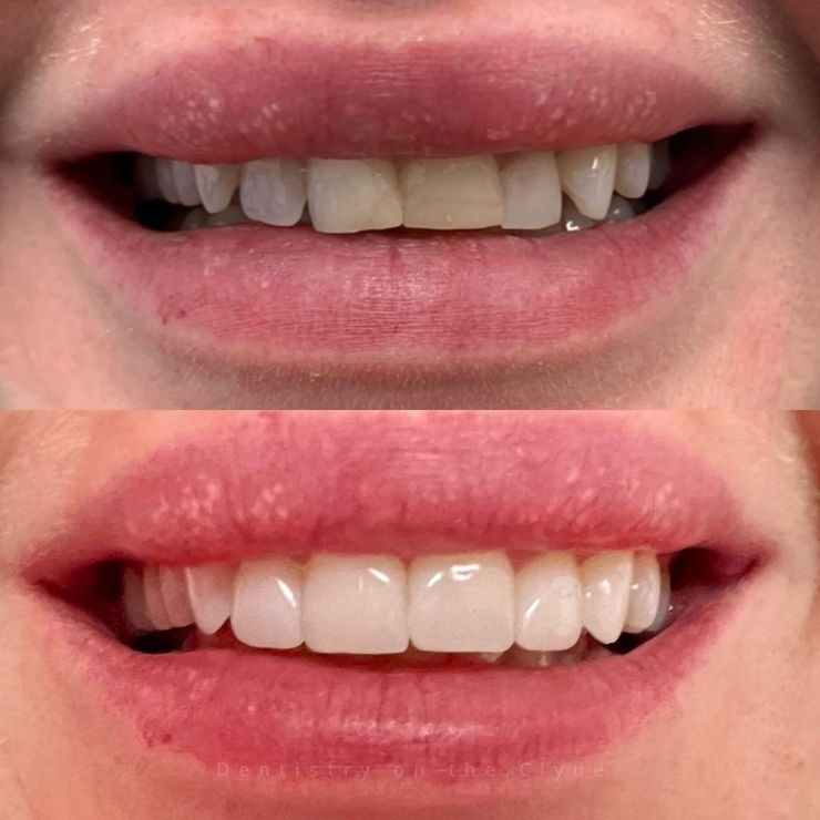 Dentistry On The Clyde | Smile Gallery Transforming Smiles