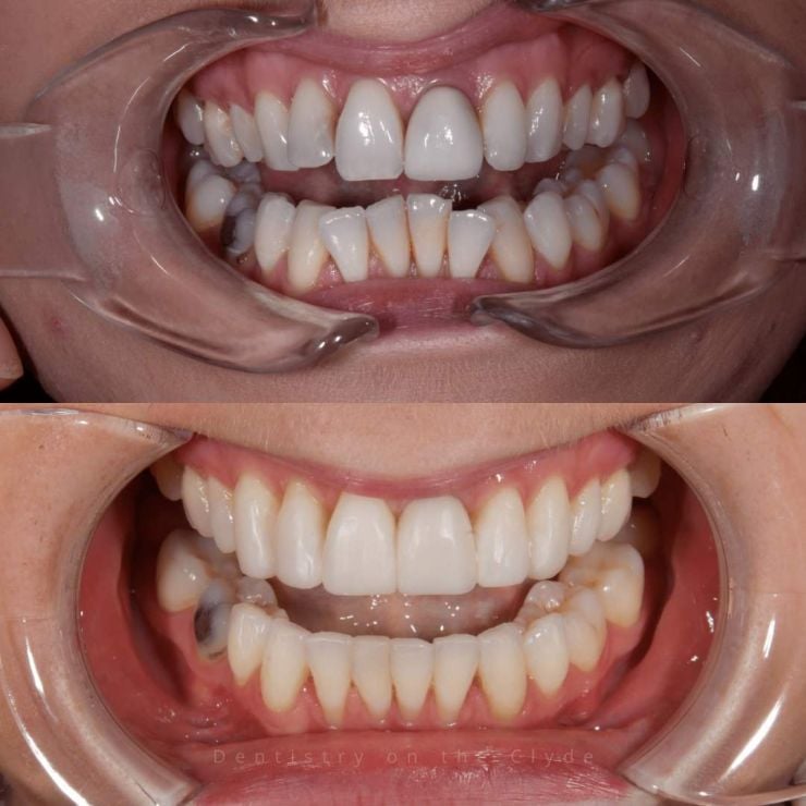Dentistry On The Clyde | Smile Gallery Dentistry On The Clyde | Smile Gallery