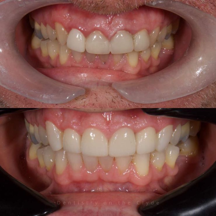 Dentistry On The Clyde | Smile Gallery Transforming Smiles
