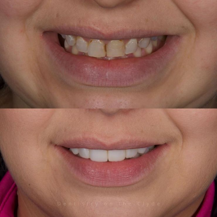 Dentistry On The Clyde | Smile Gallery Dentistry On The Clyde | Smile Gallery