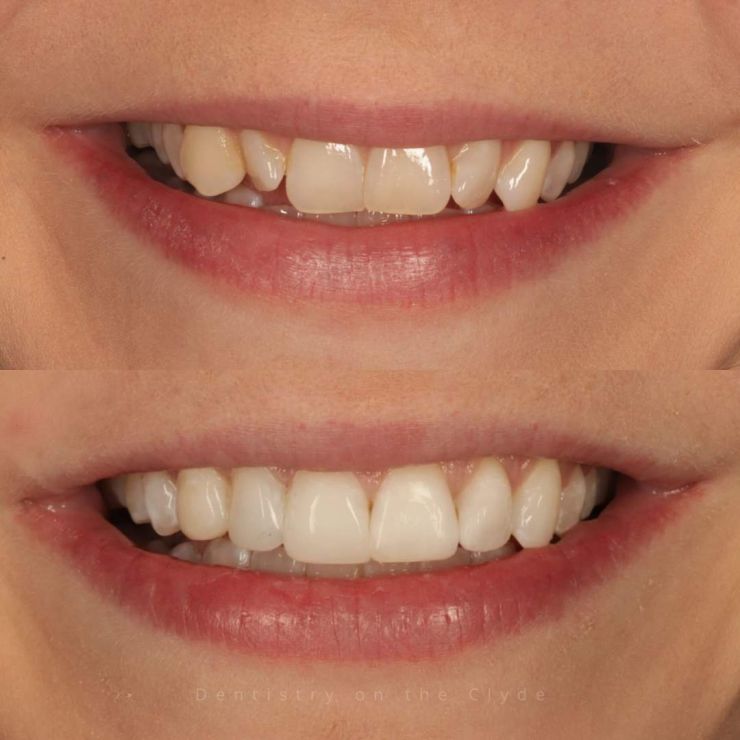 Dentistry On The Clyde | Smile Gallery Transforming Smiles