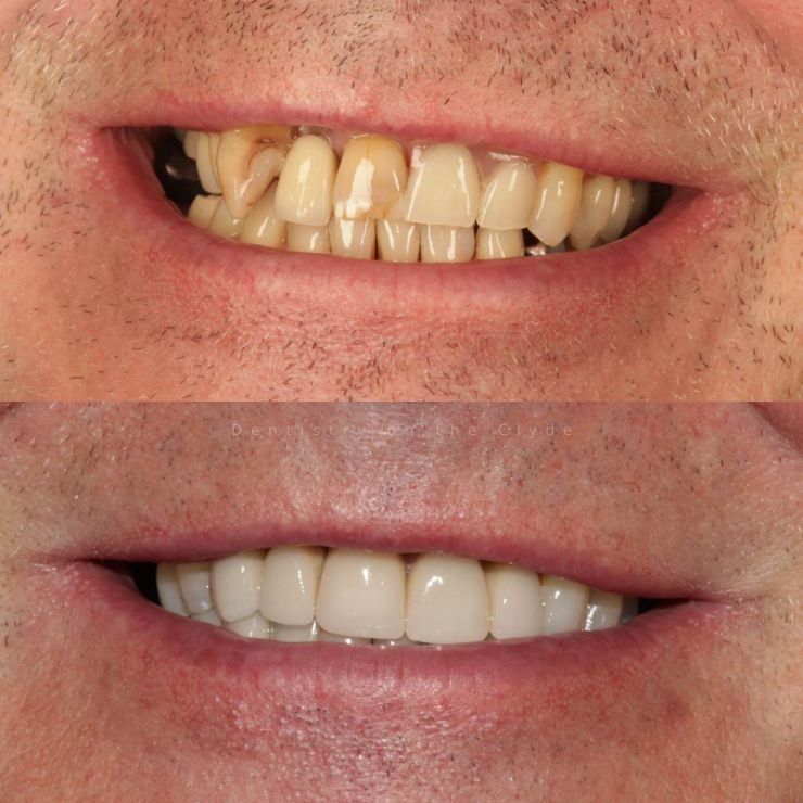 Dentistry On The Clyde | Smile Gallery Dentistry On The Clyde | Smile Gallery