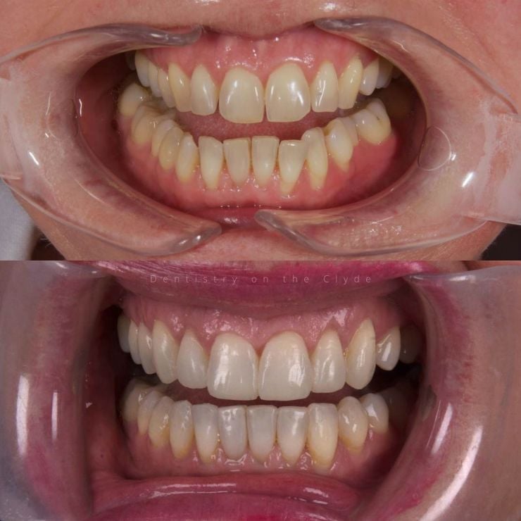 Dentistry On The Clyde | Smile Gallery Dentistry On The Clyde | Smile Gallery