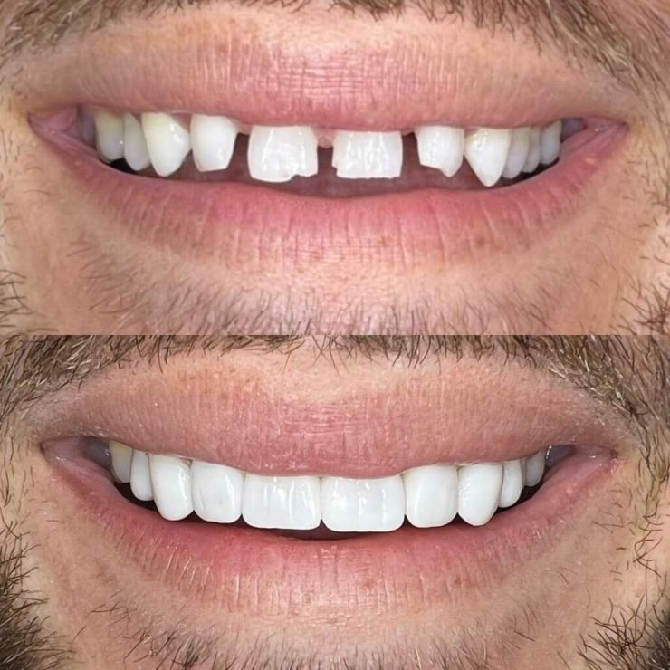 Dentistry On The Clyde | Smile Gallery Transforming Smiles