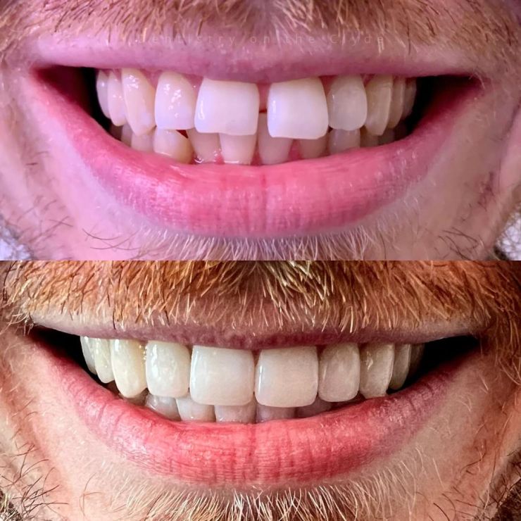 Dentistry On The Clyde | Smile Gallery Dentistry On The Clyde | Smile Gallery