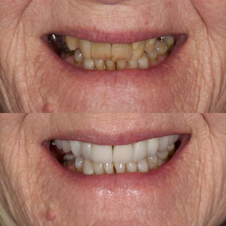 Dentistry On The Clyde | Smile Gallery Transforming Smiles