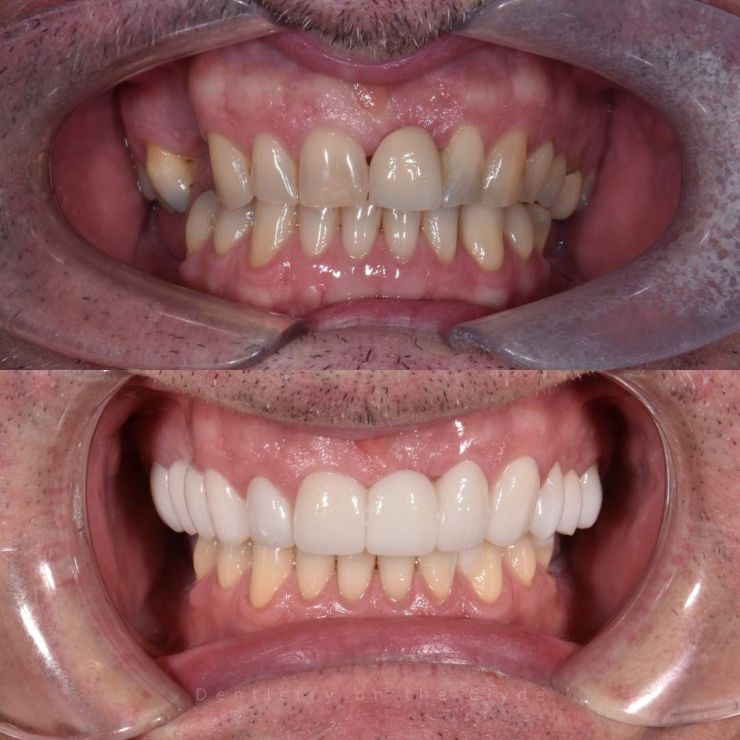 Dentistry On The Clyde | Smile Gallery Transforming Smiles