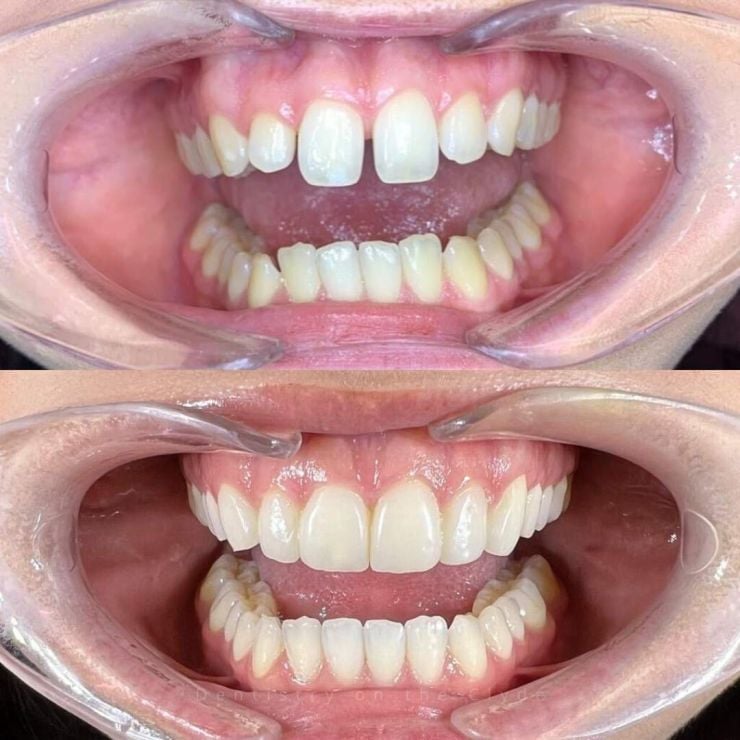 Dentistry On The Clyde | Smile Gallery Transforming Smiles