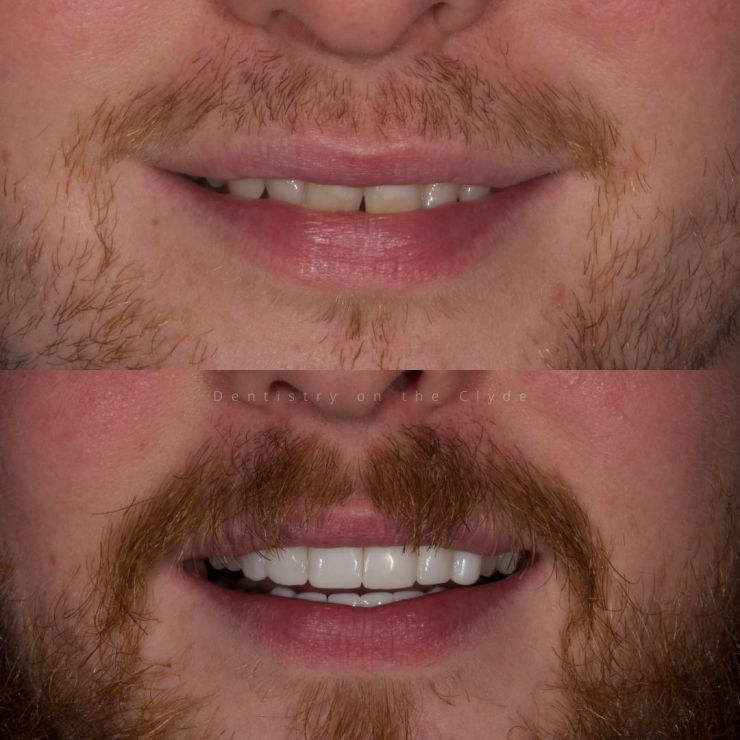 Dentistry On The Clyde | Smile Gallery Dentistry On The Clyde | Smile Gallery