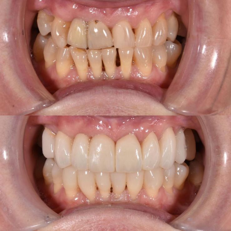 Dentistry On The Clyde | Smile Gallery Dentistry On The Clyde | Smile Gallery