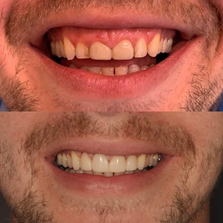 Dentistry On The Clyde | Smile Gallery Transforming Smiles