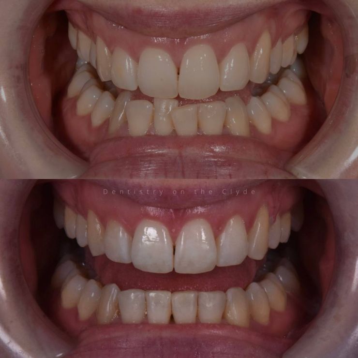 Dentistry On The Clyde | Smile Gallery Dentistry On The Clyde | Smile Gallery