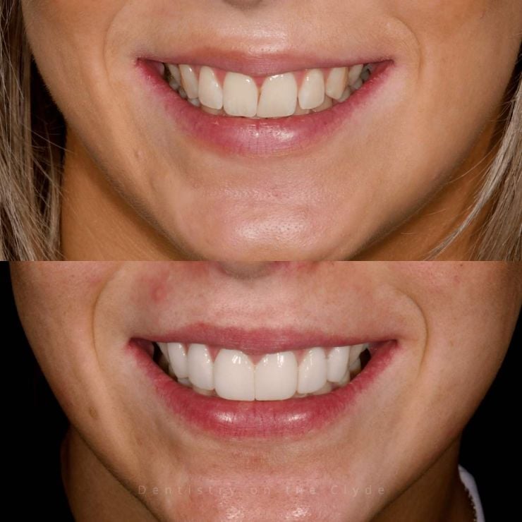 Dentistry On The Clyde | Smile Gallery Transforming Smiles