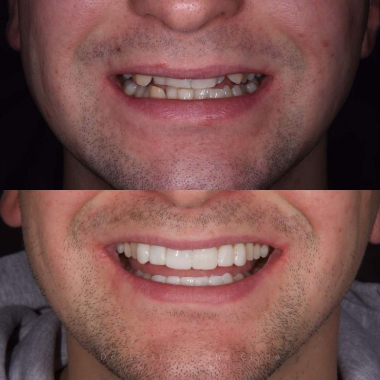 Dentistry On The Clyde | Smile Gallery Transforming Smiles