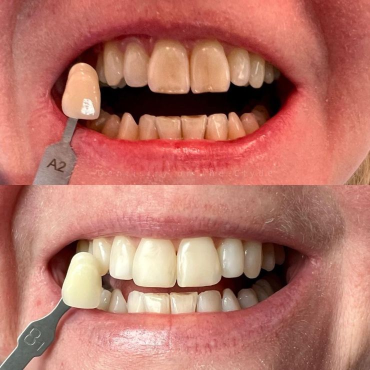 Dentistry On The Clyde | Smile Gallery Dentistry On The Clyde | Smile Gallery