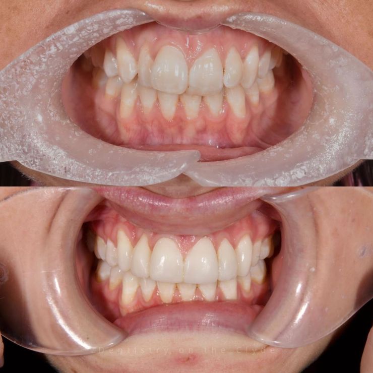 Dentistry On The Clyde | Smile Gallery Dentistry On The Clyde | Smile Gallery
