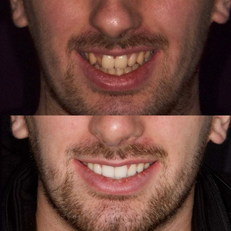 Dentistry On The Clyde | Smile Gallery Transforming Smiles