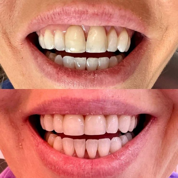 Dentistry On The Clyde | Smile Gallery Dentistry On The Clyde | Smile Gallery