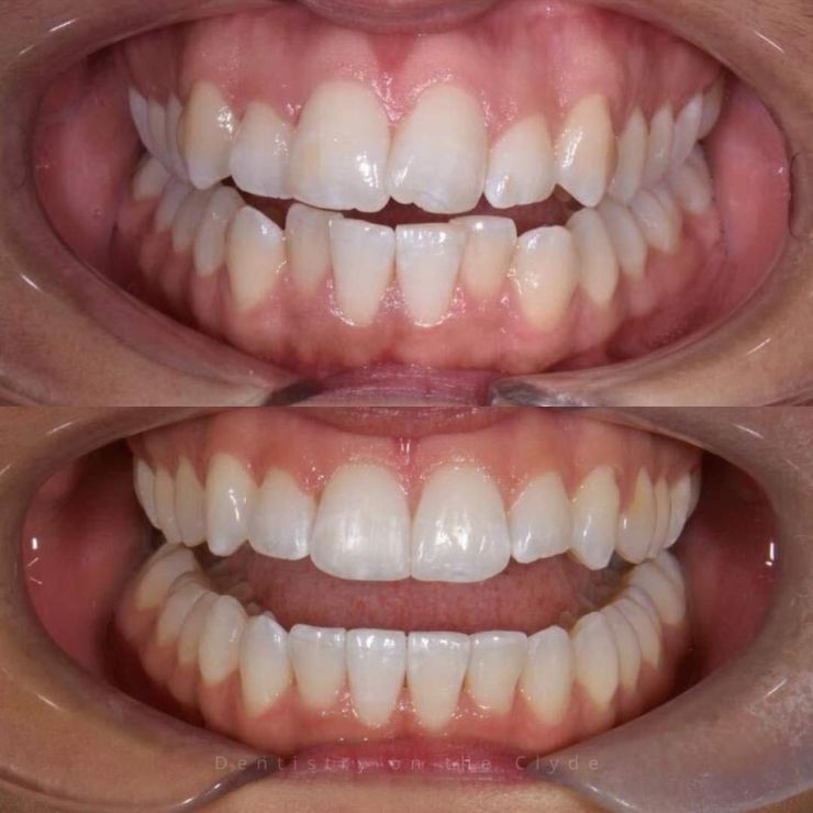 Dentistry On The Clyde | Smile Gallery Transforming Smiles