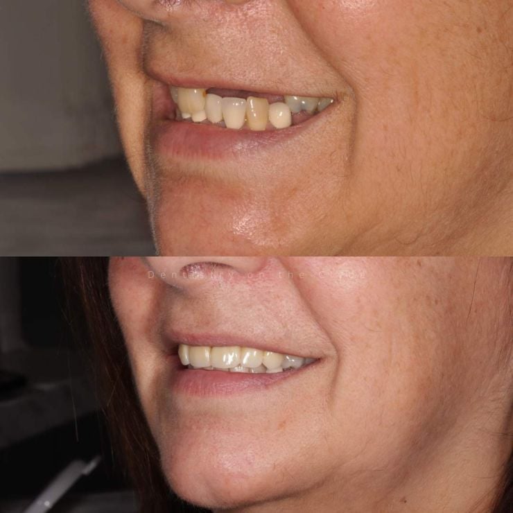 Dentistry On The Clyde | Smile Gallery Dentistry On The Clyde | Smile Gallery