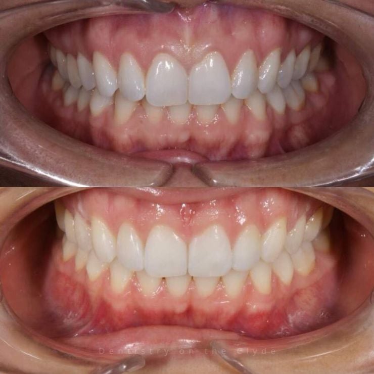 Dentistry On The Clyde | Smile Gallery Dentistry On The Clyde | Smile Gallery