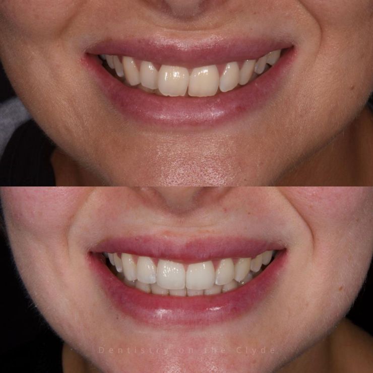 Dentistry On The Clyde | Smile Gallery Dentistry On The Clyde | Smile Gallery
