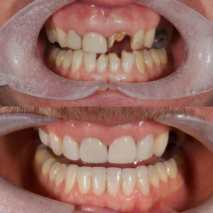 Dentistry On The Clyde | Smile Gallery Dentistry On The Clyde | Smile Gallery