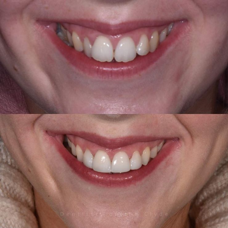 Dentistry On The Clyde | Smile Gallery Dentistry On The Clyde | Smile Gallery