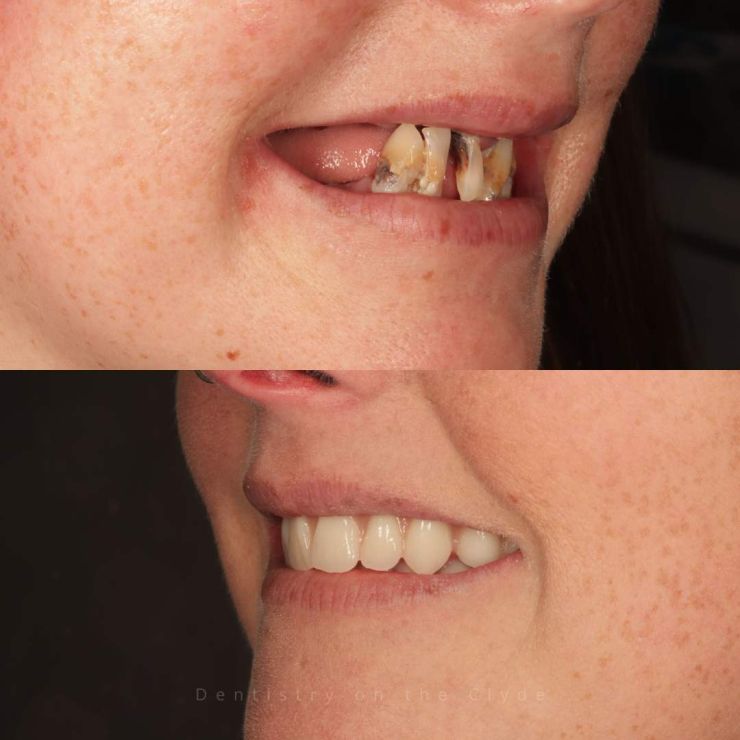 Dentistry On The Clyde | Smile Gallery Transforming Smiles