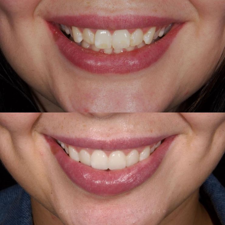 Dentistry On The Clyde | Smile Gallery Dentistry On The Clyde | Smile Gallery